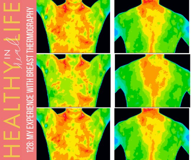 128:-my-experience-with-breast-thermography