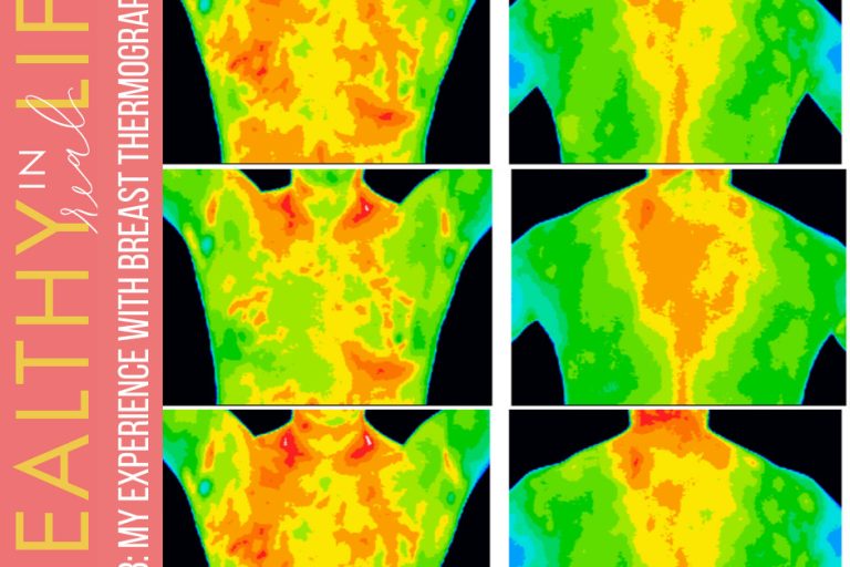 128:-my-experience-with-breast-thermography