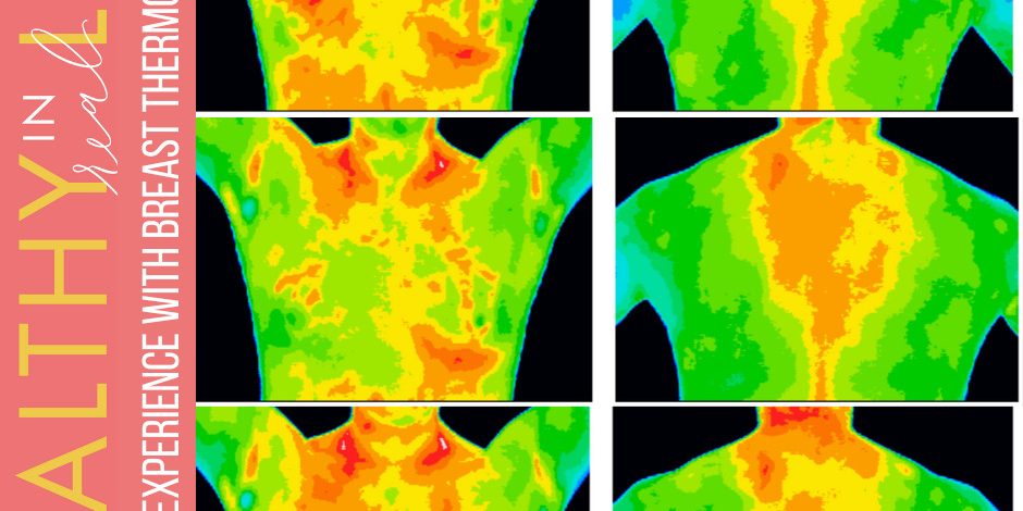 128:-my-experience-with-breast-thermography 128:-my-experience-with-breast-thermography